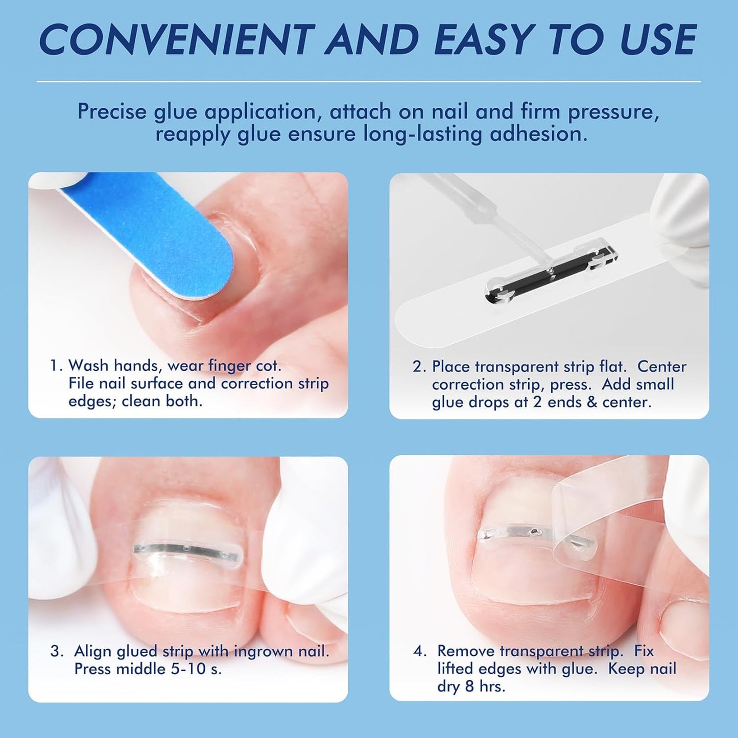 Ingrown Toenail Removal Kit – At-Home Nail Brace for Pain Relief & Correction