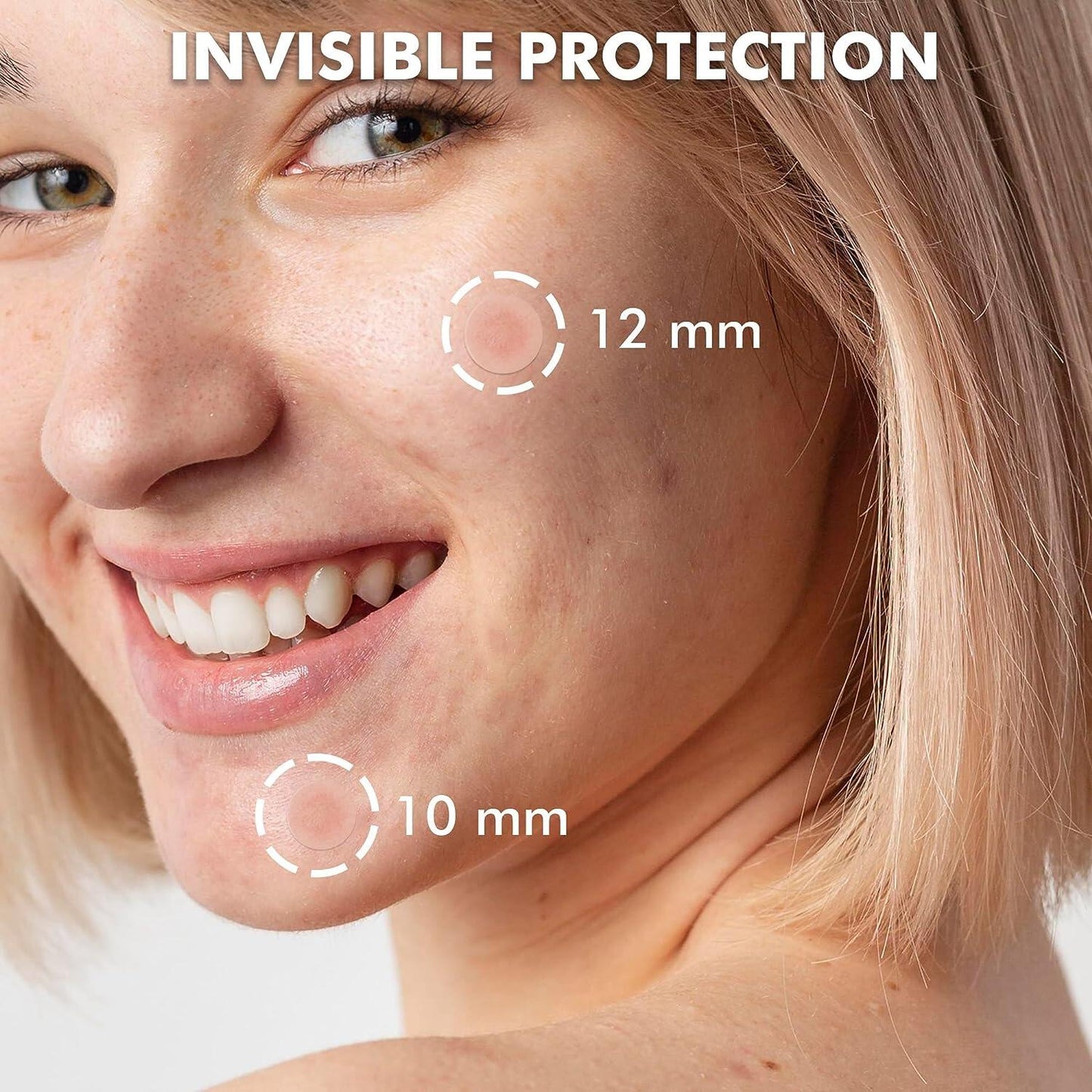 Invisible Acne Pimple Patches for Face (180 Counts), Spot Dots Cover